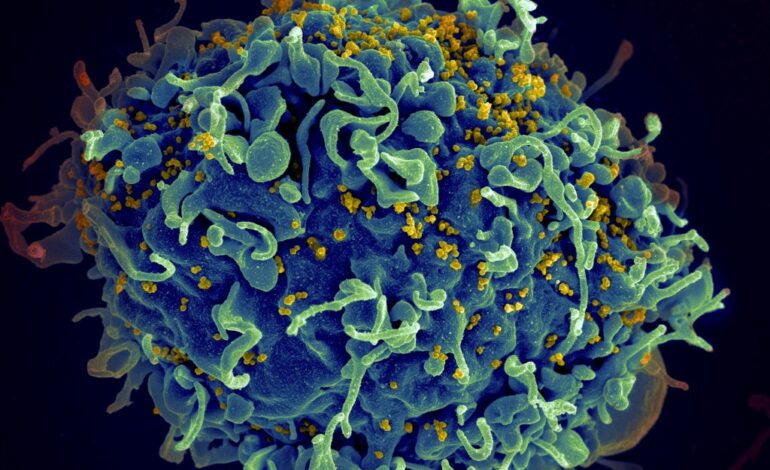 CRISPR może zabić HIV.  Ale nie wiemy, czy to lekarstwo.