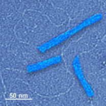 Obrazy z mikroskopu elektronowego pokazują dwie krótsze niebieskie struktury i jedną dłuższą.
