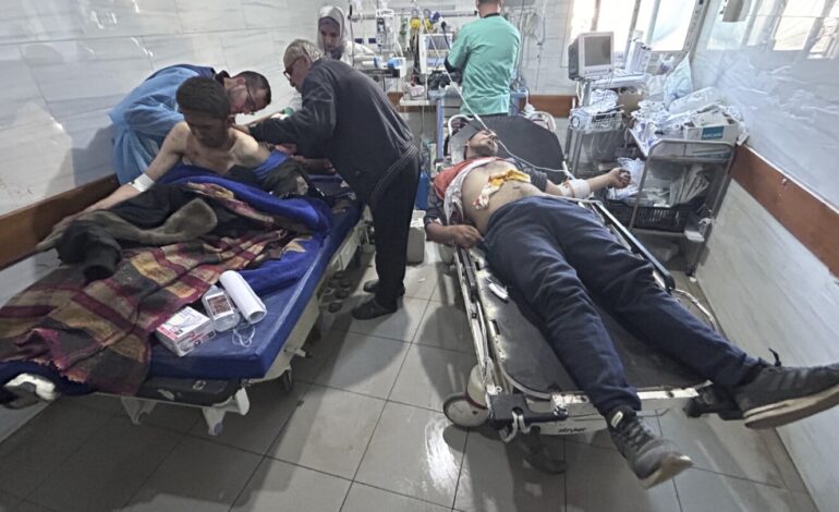 Lekarz ze Strefy Gazy twierdzi, że 80% ran w jego szpitalu spowodowanych było ostrzałem z broni palnej w wyniku rozlewu krwi w konwoju z pomocą