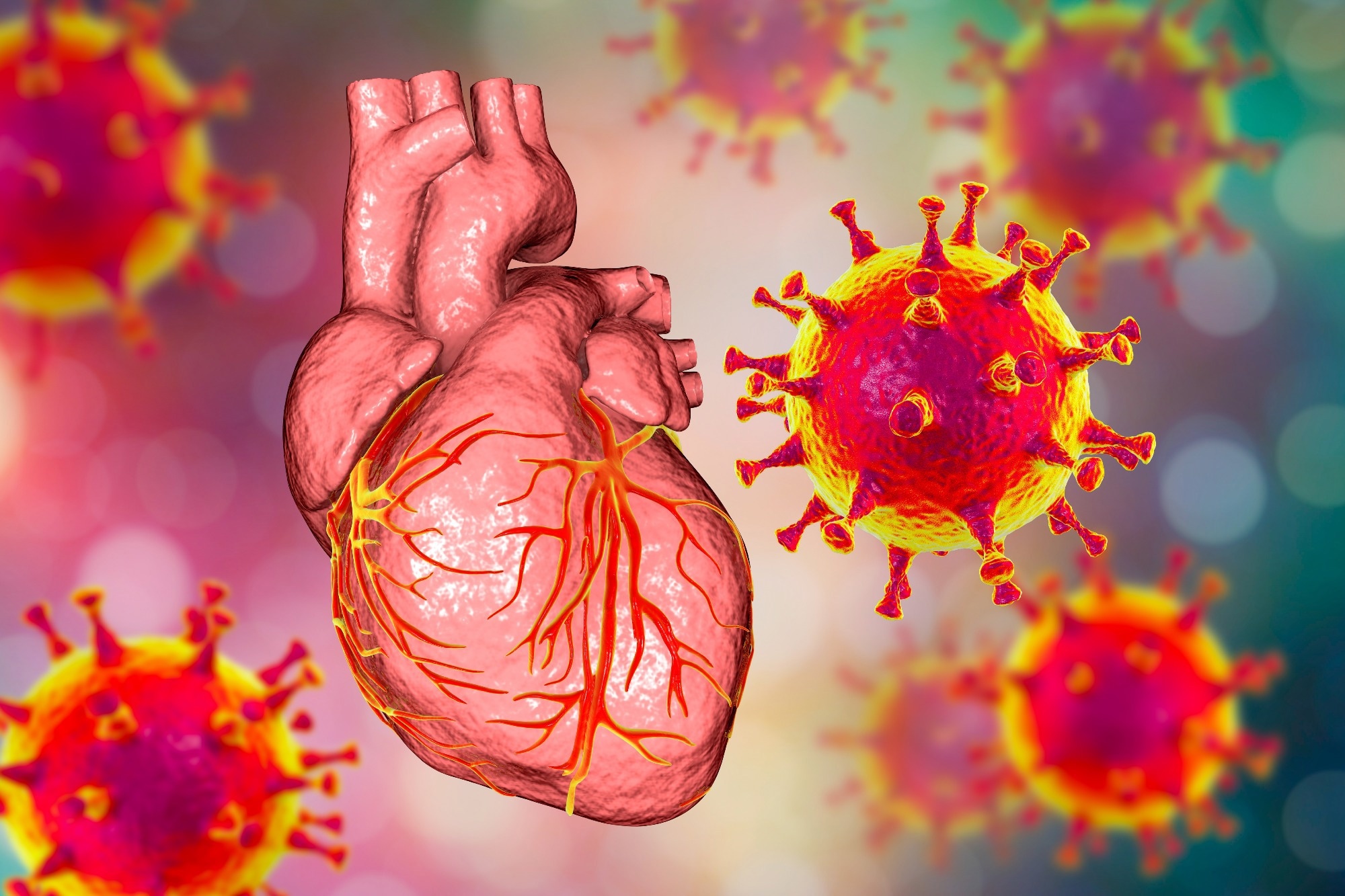 Badanie: Wywołany wirusem zespół ostrej niewydolności oddechowej powoduje kardiomiopatię poprzez wywoływanie reakcji zapalnych w sercu.  Źródło zdjęcia: Kateryna Kon / Shutterstock