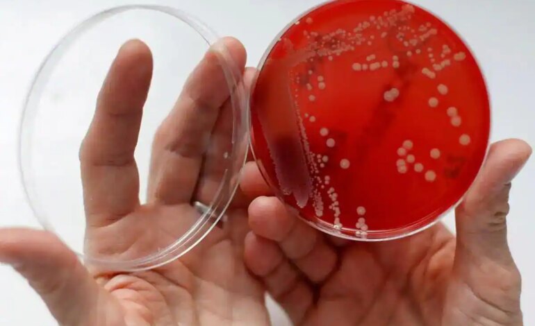 Japonia ostrzega przed śmiercionośnymi „mięsożernymi” bakteriami, które mogą przedostać się do Hiszpanii