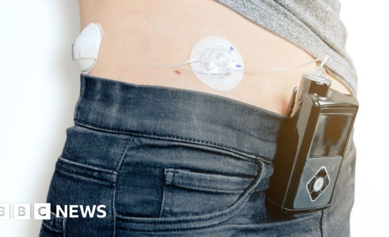 Chorym na cukrzycę zostanie zaproponowana technologia sztucznej trzustki