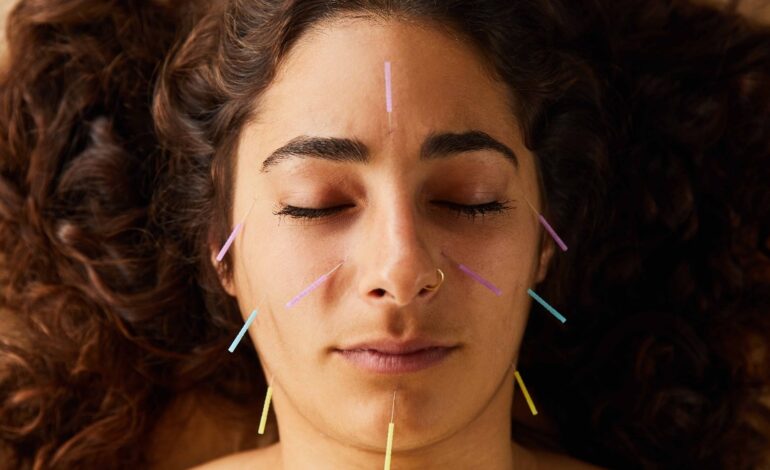 Czy akupunktura może spowolnić starzenie się?  – Indie dzisiaj