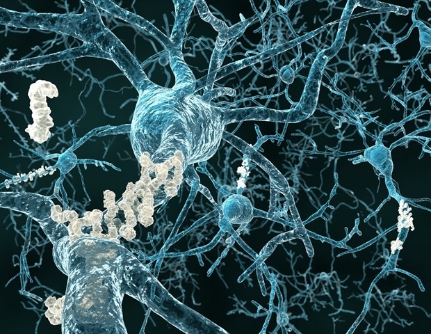 Zespołowe modele głębokiego uczenia się usprawniają wczesną diagnostykę choroby Alzheimera przy użyciu danych neuroobrazowych