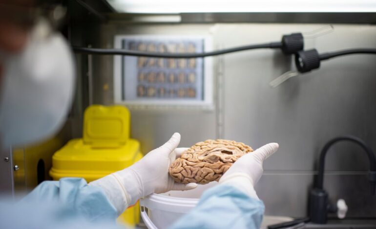 Naukowcy zidentyfikowali nową genetyczną postać choroby Alzheimera, która występuje u milionów ludzi |  Nauka