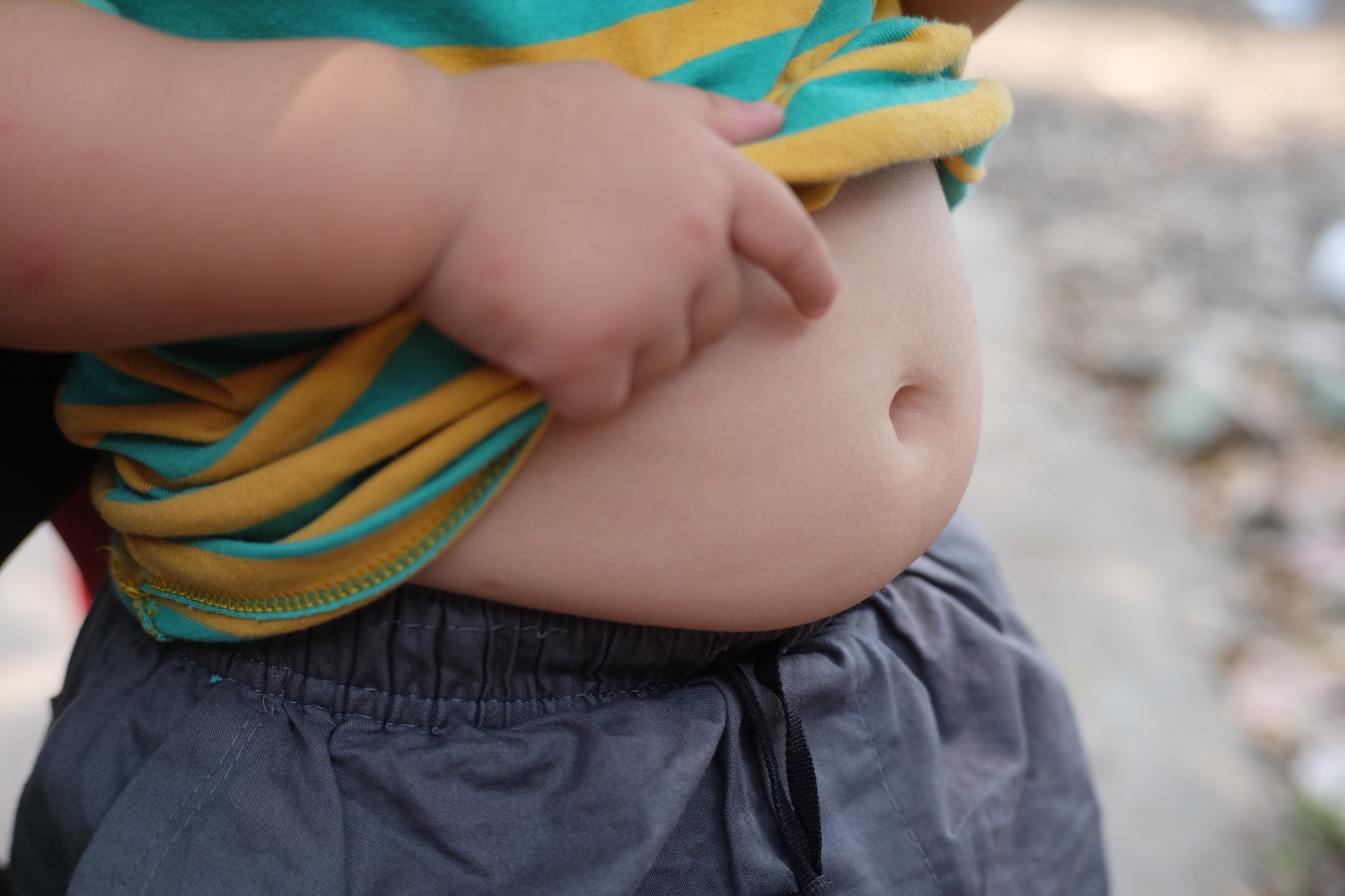 Badanie: Związek przyczynowy między mikroflorą jelitową a otyłością u dzieci: badanie randomizacyjne Mendla i badanie kliniczno-kontrolne.  Źródło zdjęcia: Leeferiin / Shutterstoc