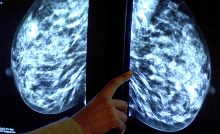 Nowy system sztucznej inteligencji pomaga ulepszyć diagnostykę raka piersi