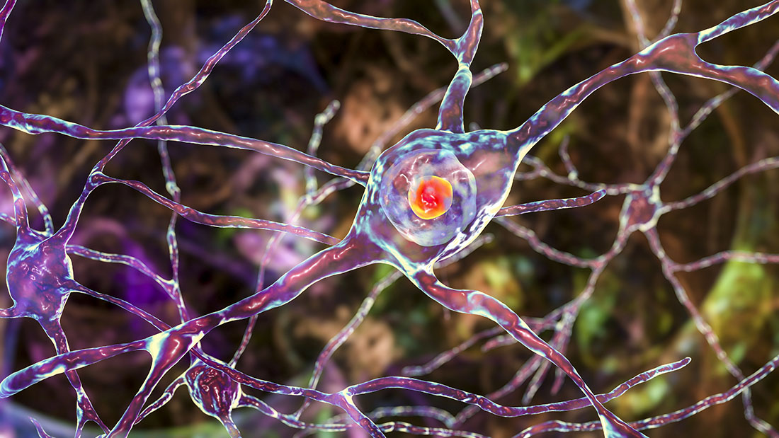 Ilustracja 3D neuronalnej inkluzji wewnątrzjądrowej