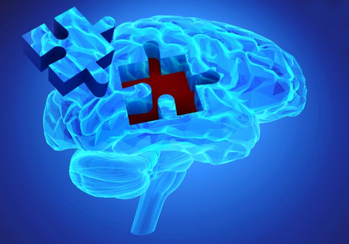 Obraz mózgu z brakującym elementem układanki, ilustrujący utratę pamięci w chorobie Alzheimera i demencji