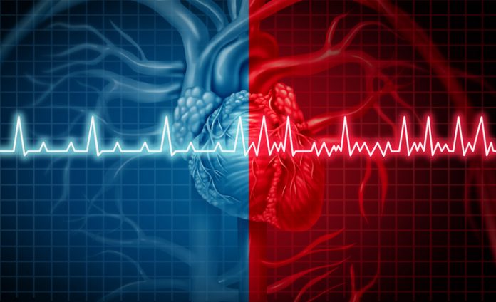 Migotanie przedsionków i koncepcja prawidłowego lub nieprawidłowego rytmu serca jako zaburzenie serca jako narząd ludzki ze zdrowym i niezdrowym monitorowaniem EKG w stylu ilustracji 3D w celu zilustrowania nagłej śmierci sercowej