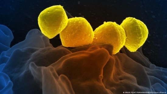 W Japonii rośnie liczba zakażeń bakterią Streptococcus pyogenes.  Zakażenia powodują śmiertelną chorobę zwaną zespołem wstrząsu toksycznego paciorkowcowego (STSS).  (IMAGE POINT FR/NIH/NIAID/BSIP/picture Alliance )