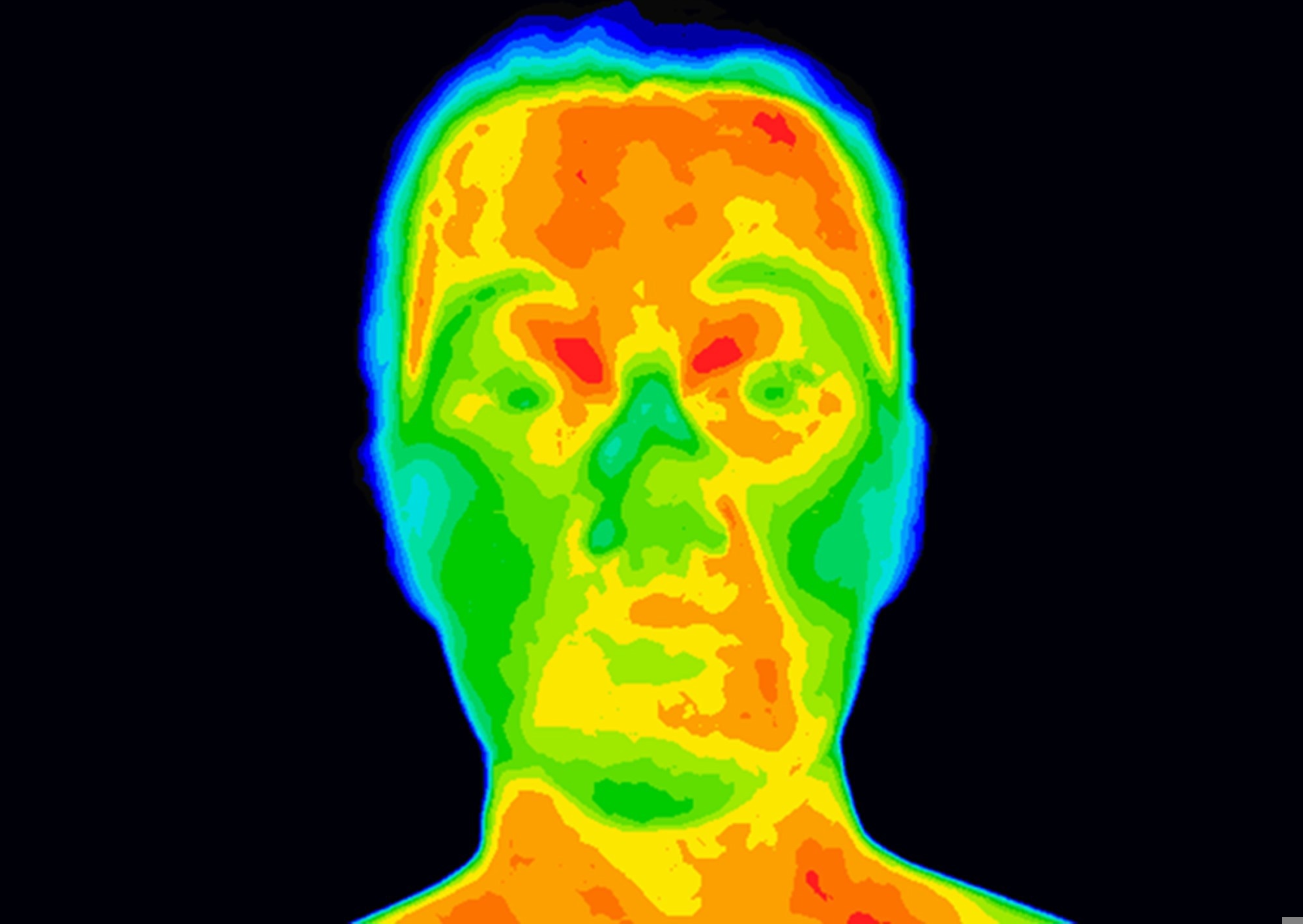 Badanie: Przewidywanie choroby wieńcowej na podstawie informacji o temperaturze twarzy zarejestrowanych za pomocą bezkontaktowej termografii w podczerwieni.  Źródło zdjęcia: Anita van den Broek / Shutterstock