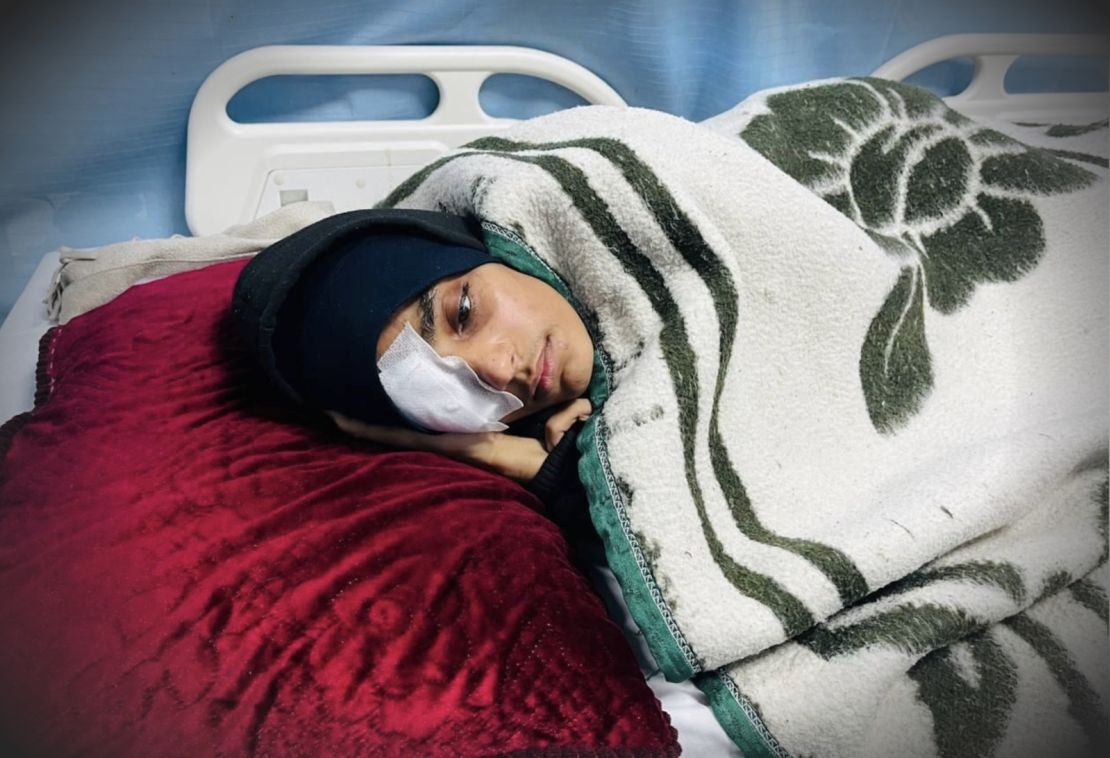 Roba Abu Jibba na zdjęciu w szpitalu w Strefie Gazy po ataku.