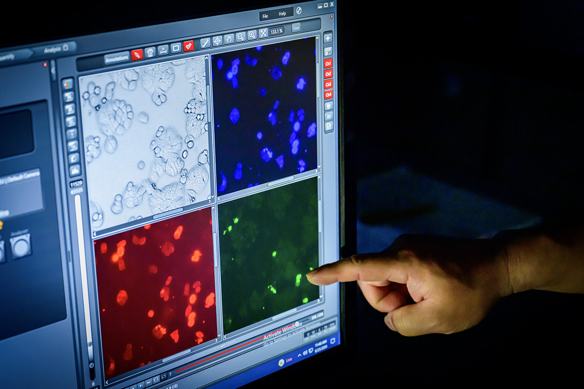 Obrazy mikroskopowe komórek nowotworowych na ekranie
