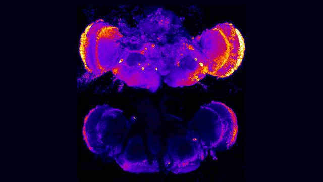 Celowanie w białka naprawy komórek oferuje nową drogę do wczesnej interwencji w chorobie Alzheimera